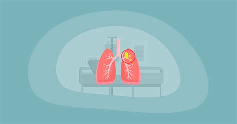 lung cancer charities list.